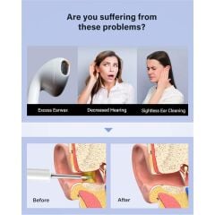 BEBIRD T5 3MP KAMERA 3.5MM LENS ŞARJLI WIFI GÖRÜNTÜLÜ KULAK TEMİZLEYİCİ BEYAZ RENK